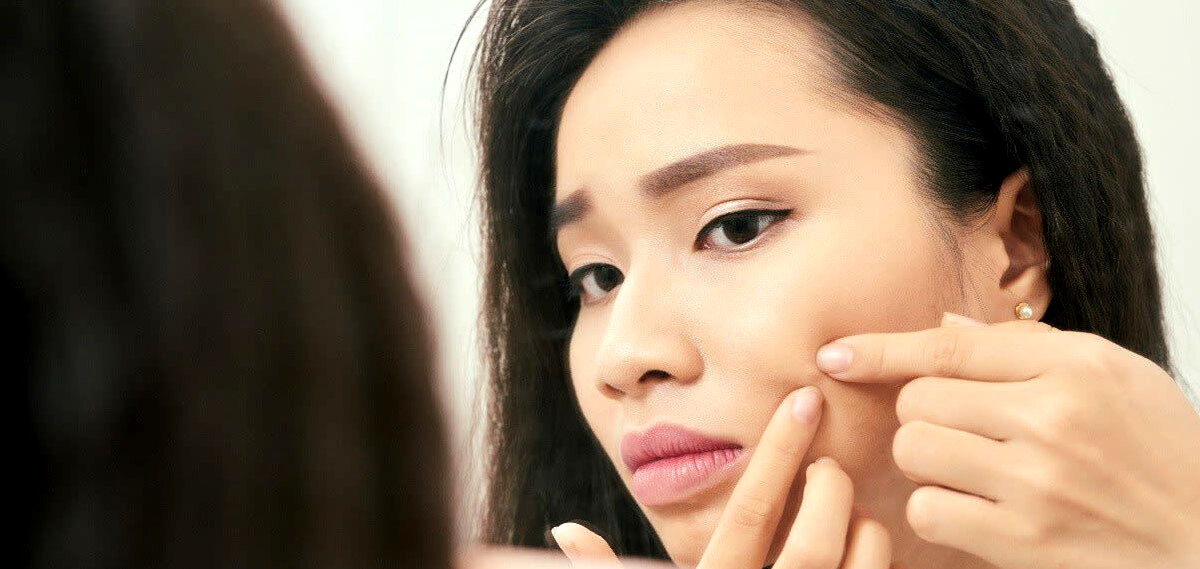 جوش بعد از اصلاح؛ معضل روزهای گرم! + راهکار خانگی 