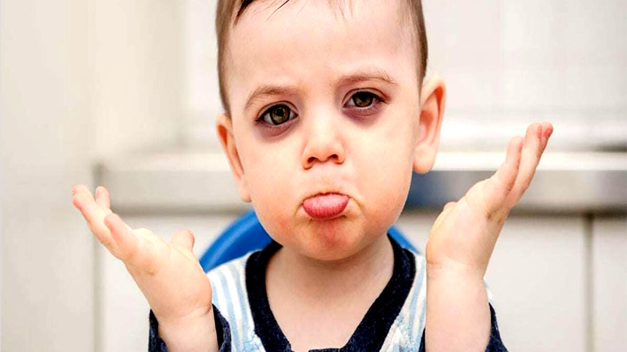 چرا زیر چشم کودکان سیاه می شود؟ | راهکارهای خانگی برای رفع سیاهی زیر چشم کودکان 