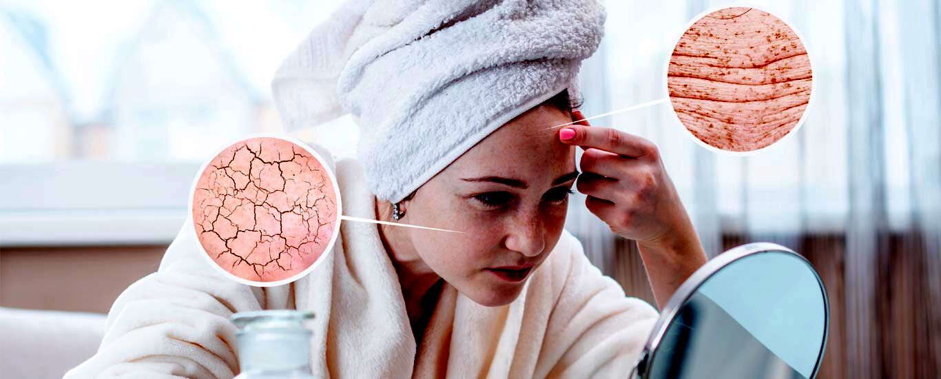 روش های طبیعی رفع خشکی پوست