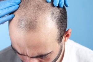 مزاج بلغمی یا سرد و تر چیست و چه خصوصیاتی دارد؟ 