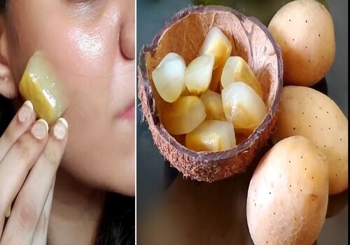 ماسک یخ و سیب زمینی، معجزه طبیعی برای مشکلات پوستی + ویدیوی طرز تهیه 